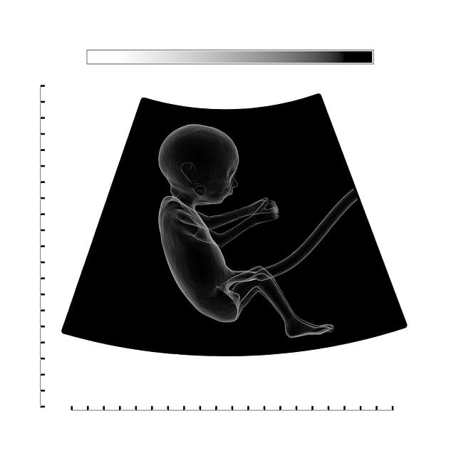 Doporučené postupy při ultrazvuku plodu: Podrobnosti o správném používání⁣ techniky a vybavení