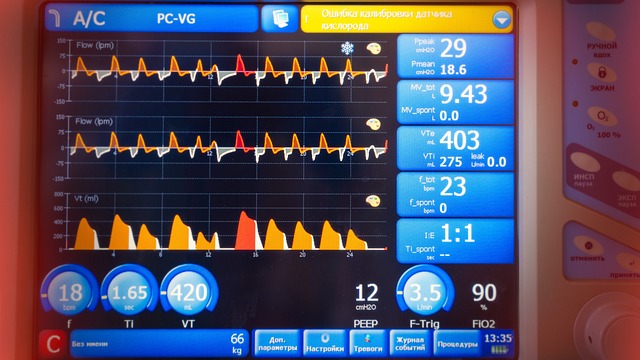Kontrola monitoru dechu: Jak zkontrolovat správnou funkci?
